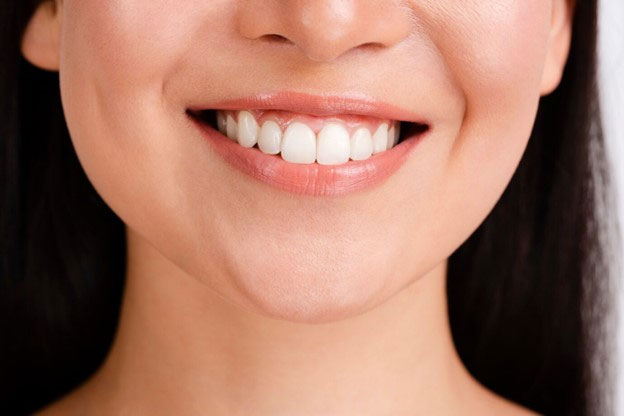 ฟอกฟันขาว (Zoom Teeth Whitening) คืออะไร มีข้อดีอะไรบ้าง 